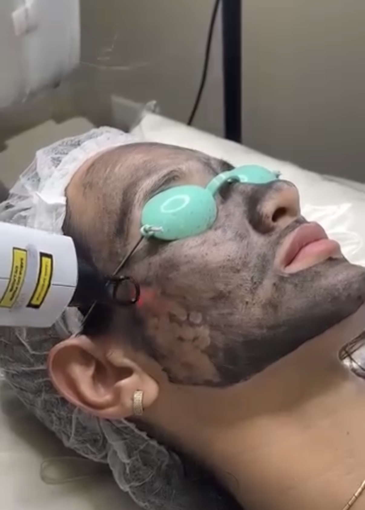 Black Peel