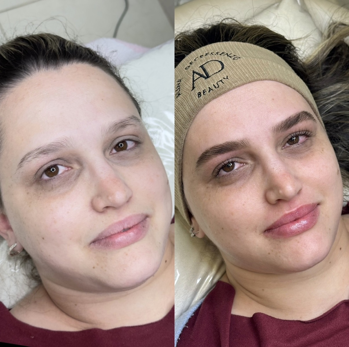 Brows Repair