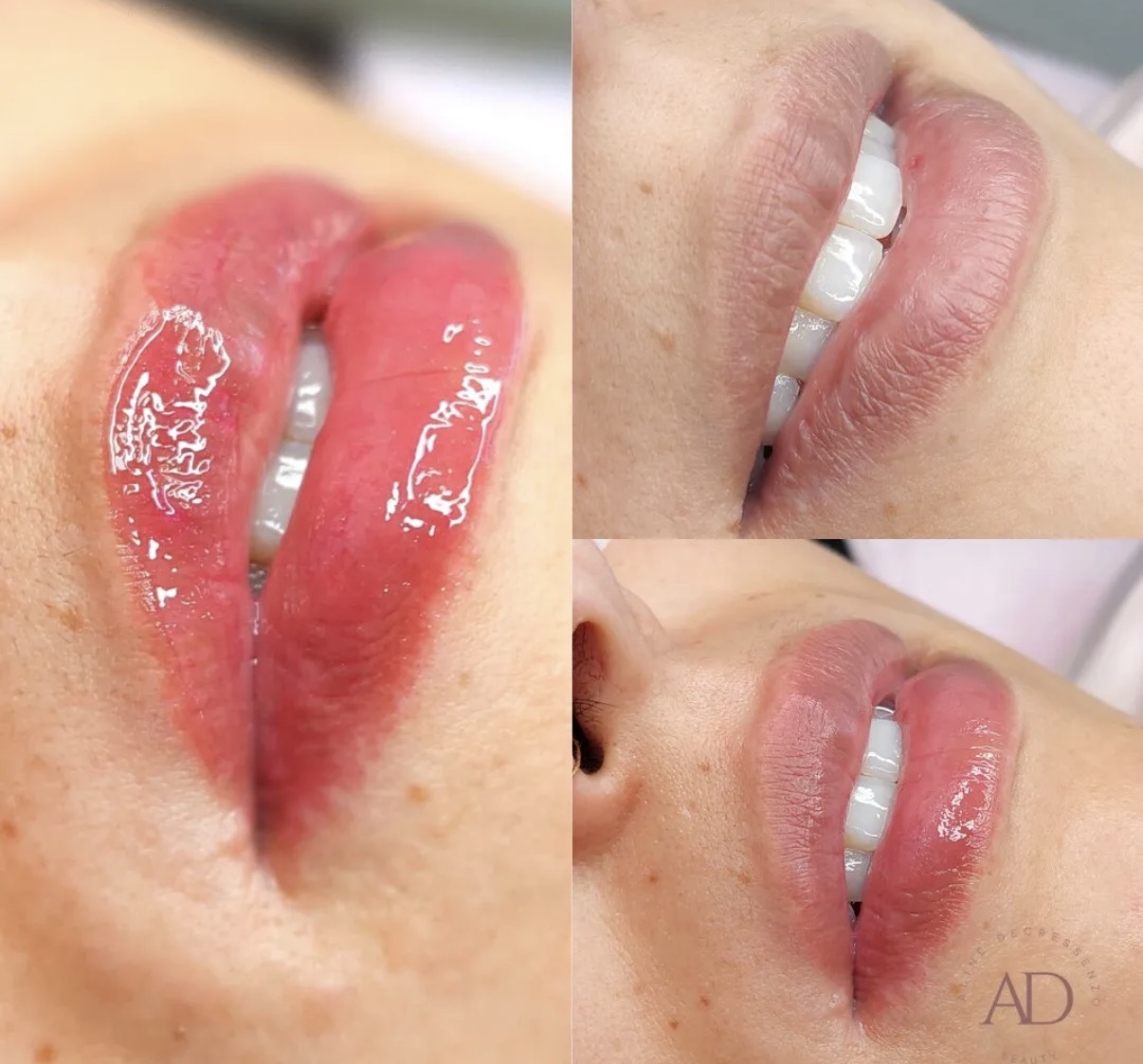 Hidragloss